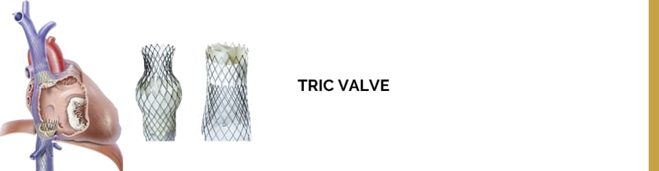 TRIC VALVE é uma técnica de tratamento para insuficiência tricúspide sintomática.