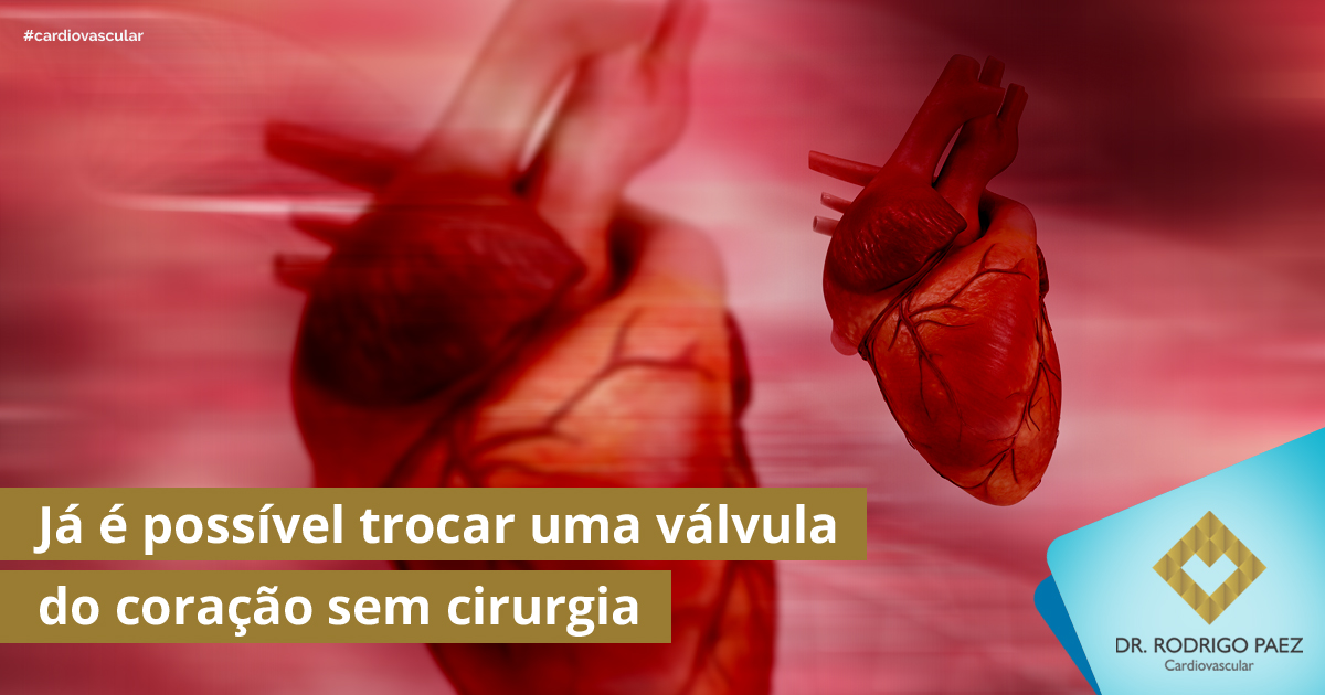 Já é Possível Trocar Uma Válvula Do Coração Sem Procedimentos Cirúrgicos Dr Rodrigo Paez 9326