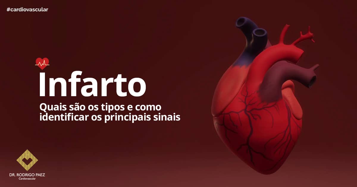 Quais são os principais sinais de infarto? • Summit Saúde Estadão
